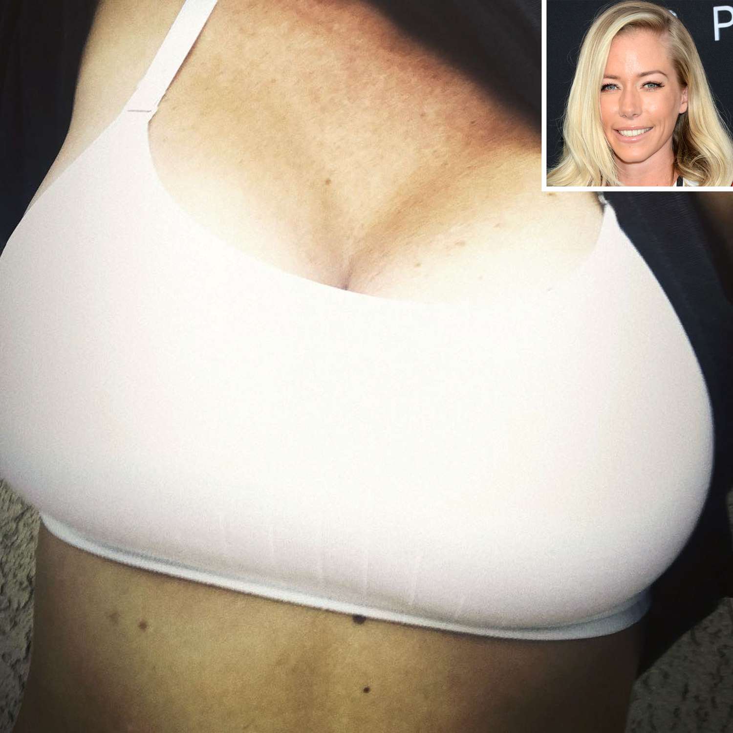 Kendra Wilkinson Flashes Her Nice Breast Implants Nude Boobs