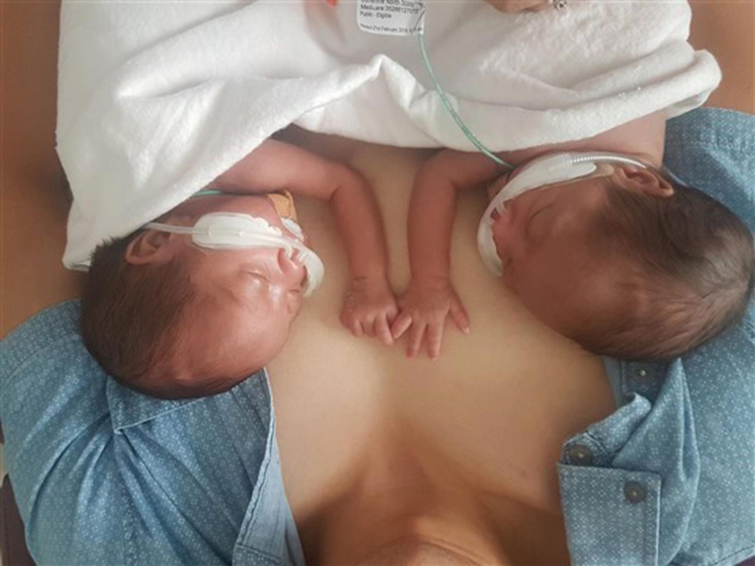 Ann-Le-mono-amniotic-twins-3