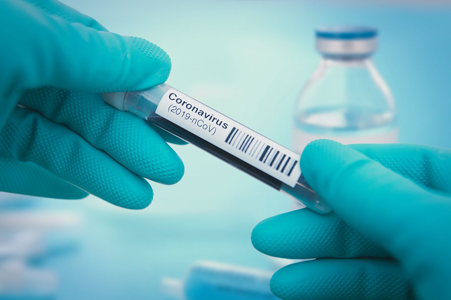 coronavirus test sample