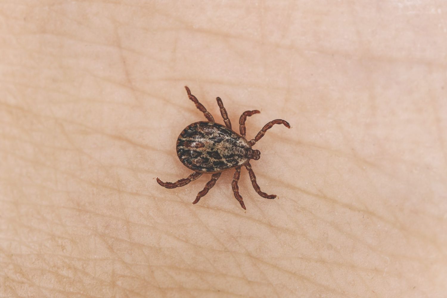 Lyme Disease - Tick