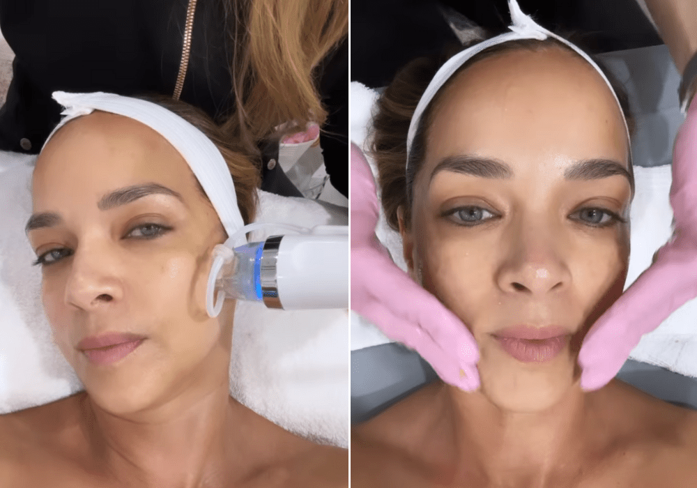 Adamari López tratamiento rejuvenecer rostro y cuello