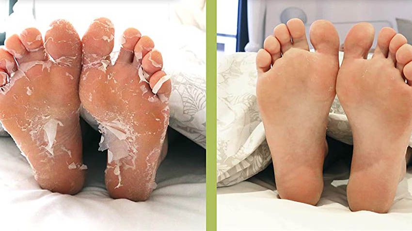 The Plantifique Foot Peel Mask from Amazon Is Giving Shoppers the Grossest  (But Most Satisfying) Results | Southern Living