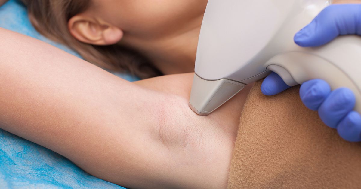 Everything You Need To Know About Laser Hair Removal Shape.