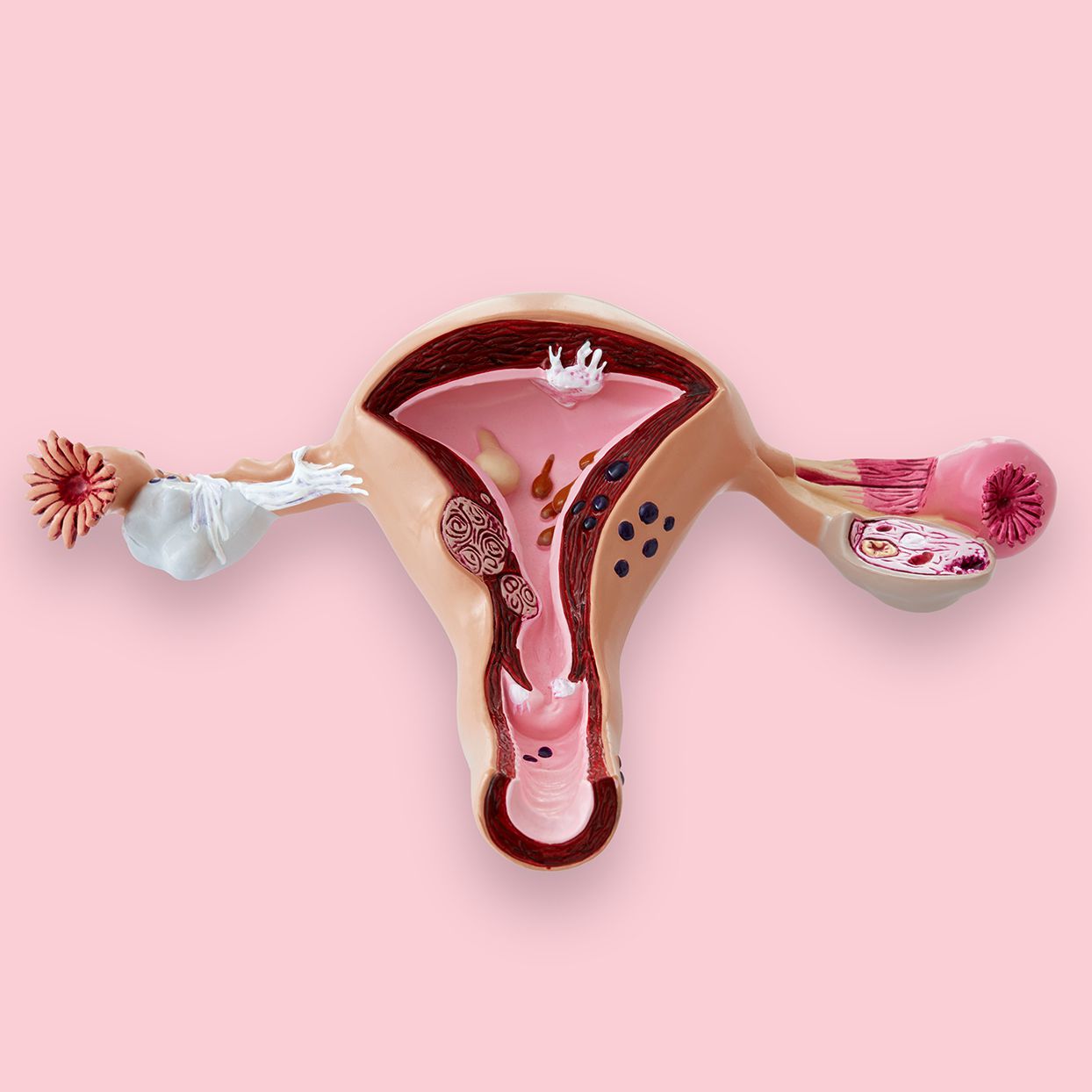 Model of a uterus