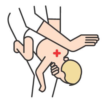 Infant Choking First Aid