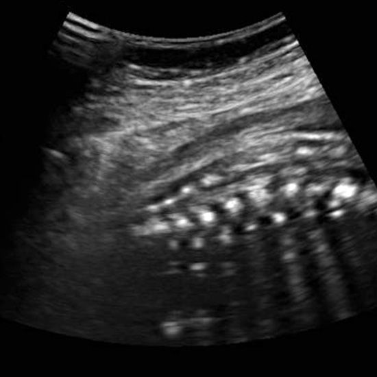 ultrasound week 31