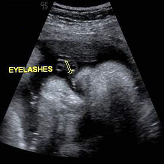 39 Week Ultrasound