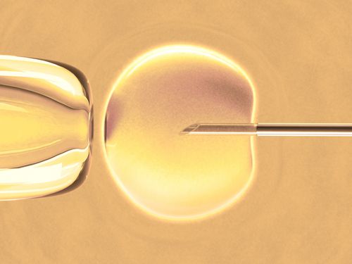 Study: More Embryos Not Necessarily Better in IVF 29438