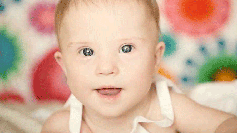 Baby Care Basics: What is Down Syndrome?