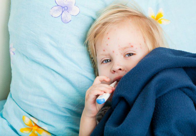 Sick-Girl-Child-Measles