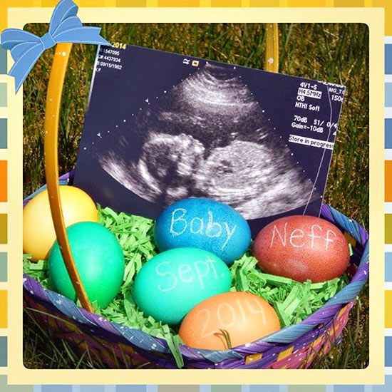 Easter Pregnancy Sign Photo Prop Expecting Pregnancy Poster New Baby Baby R...