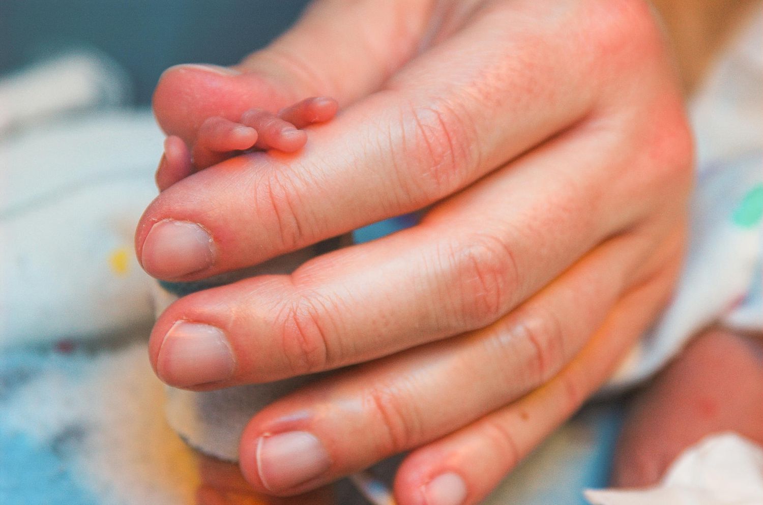 hand of premature baby in nicu
