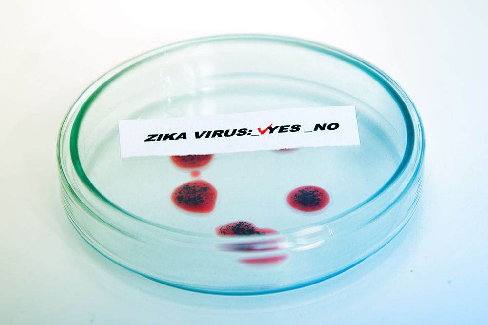 zika virus test positive