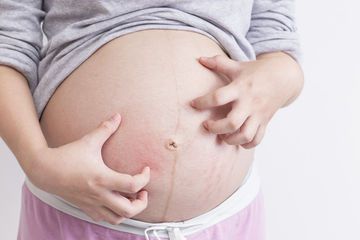 Mom Warns Severe Itchiness During Pregnancy Might Be More Dangerous Than It Seems_still