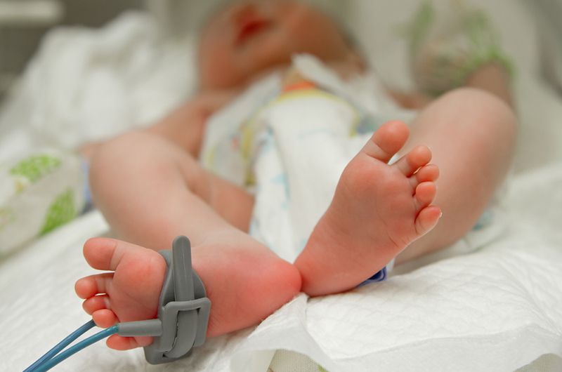 newborn baby with a foot monitor