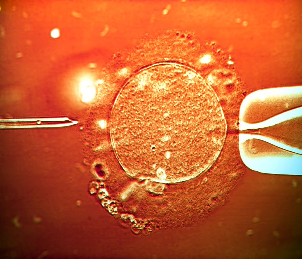IVF sperm injected into egg