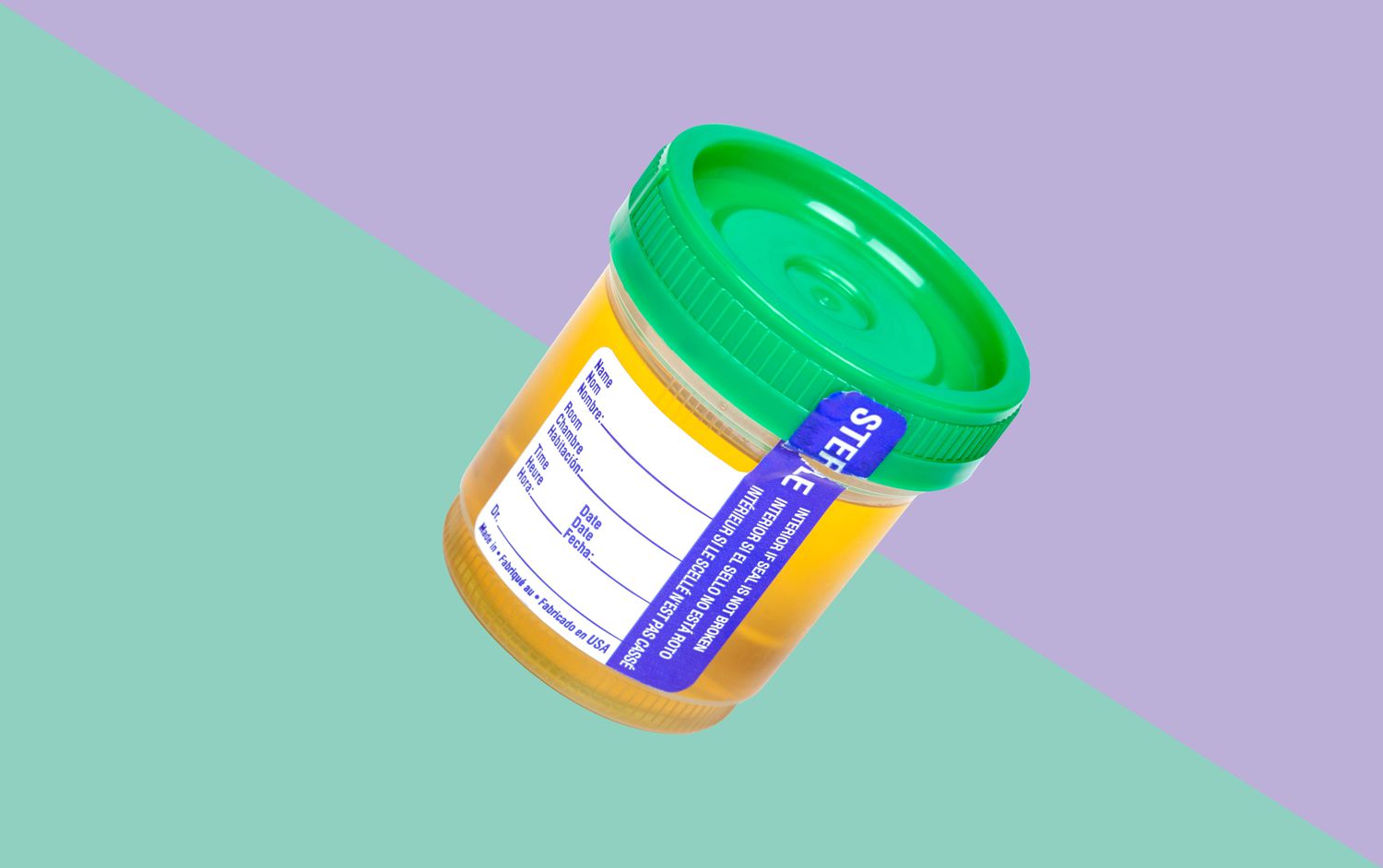 container of urine
