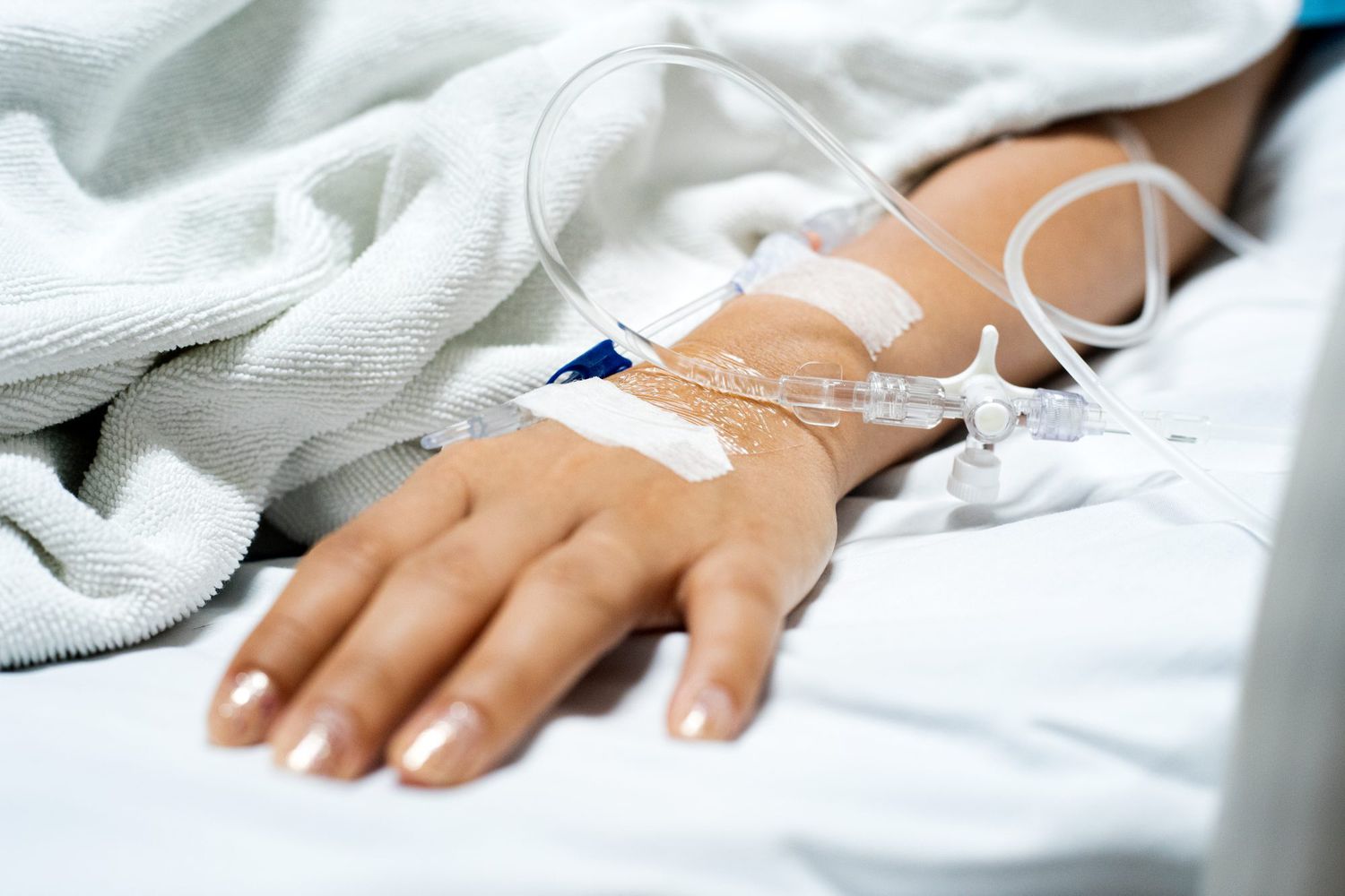 An image of a hand on a hospital bed.