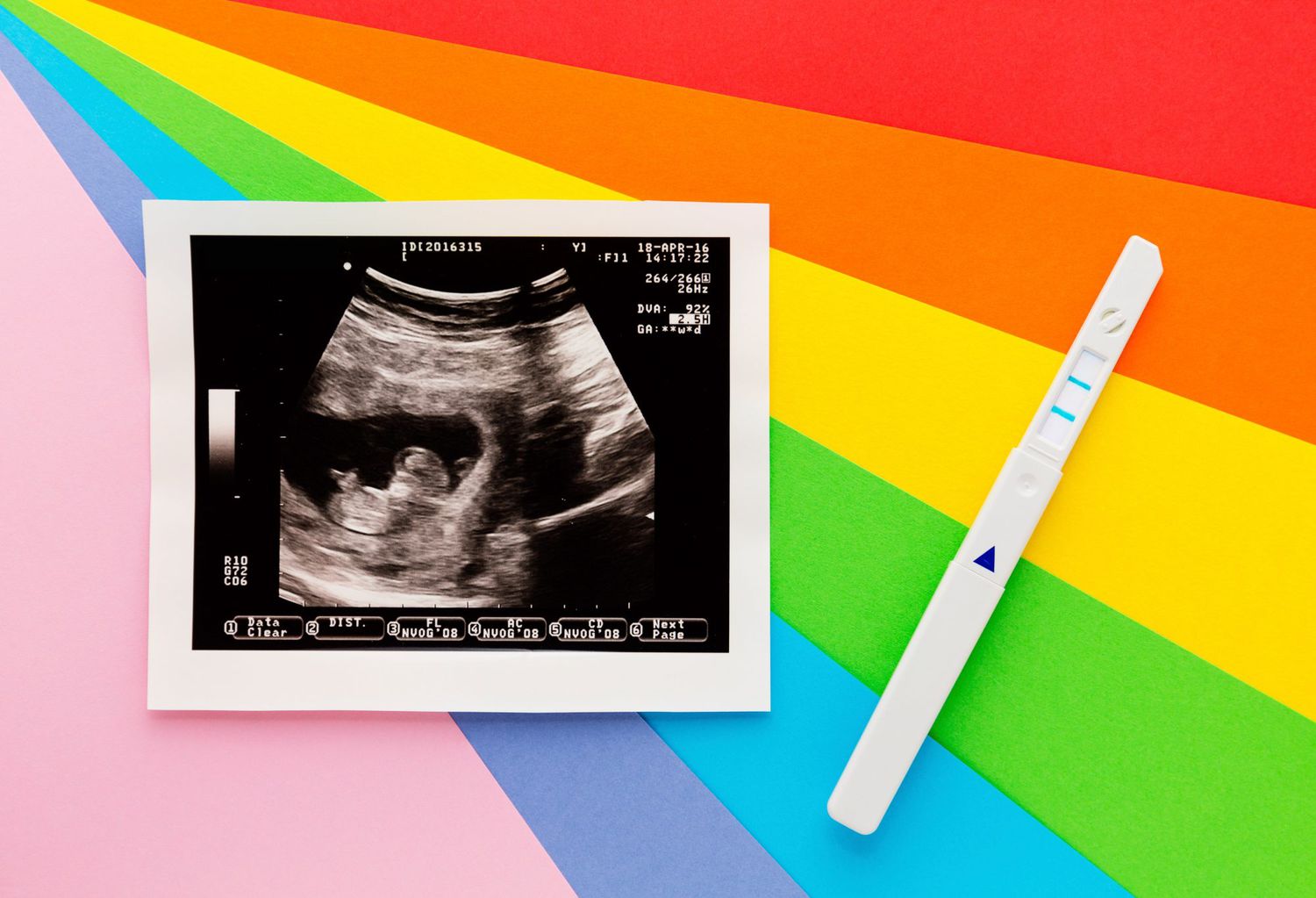 An image of a sonogram on a rainbow background.
