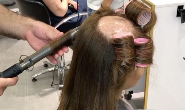 This hair stylist transformed this woman's bald spot and created a