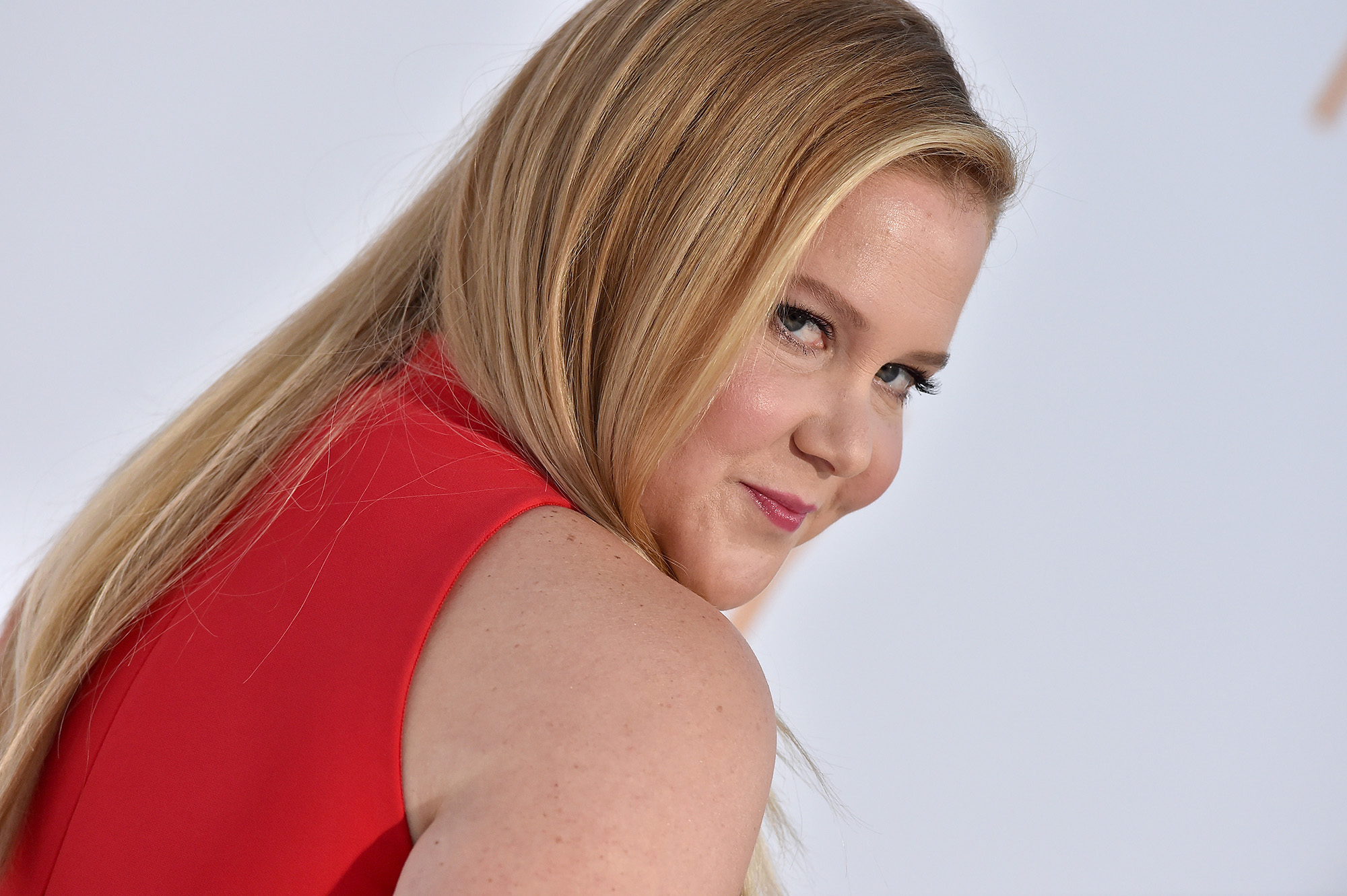 Amy Schumer Shows Fans Her C-Section Scar In New Viral 