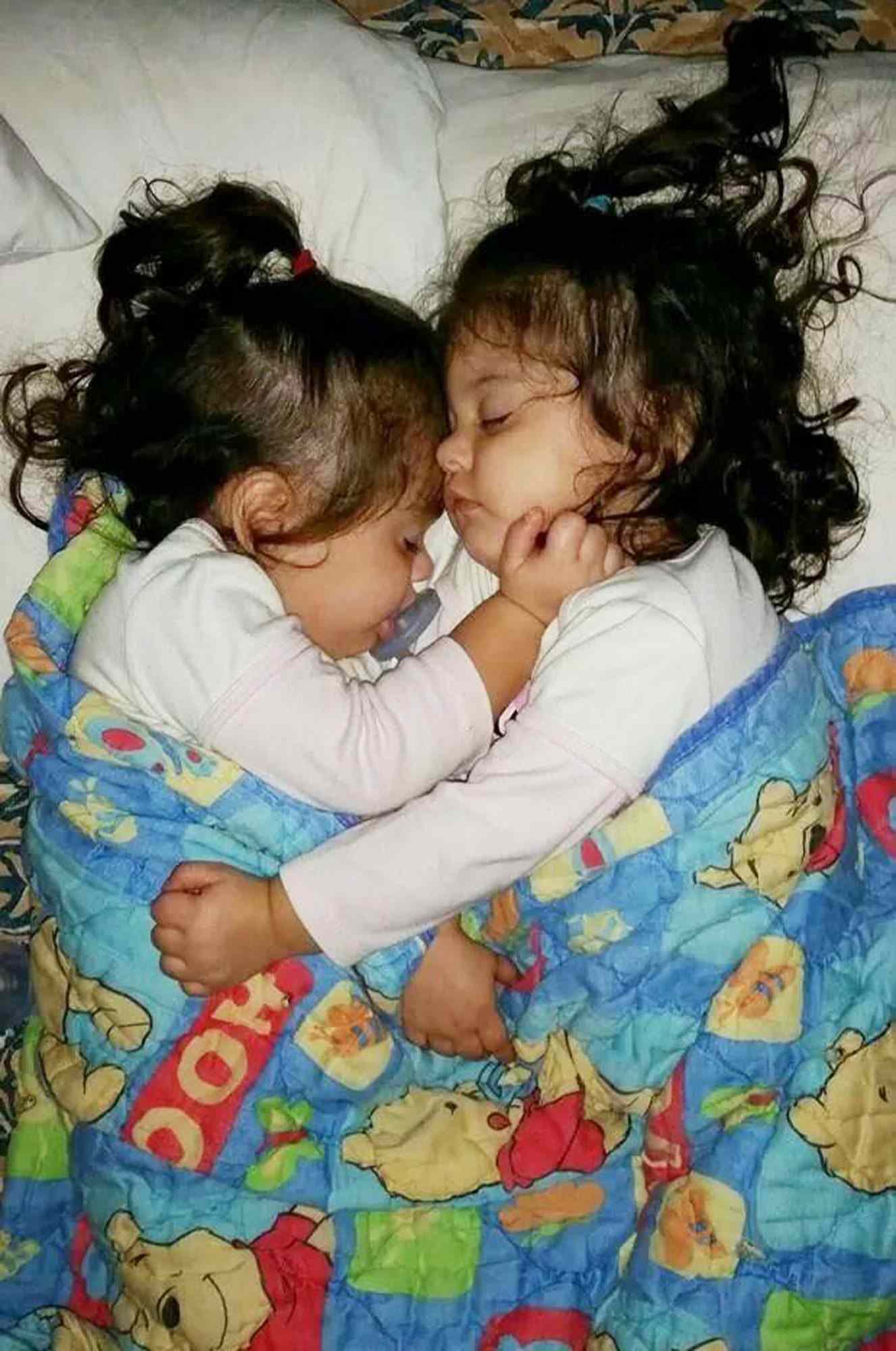 4YearOld Twin Girls Cope with One Sister's Cancer