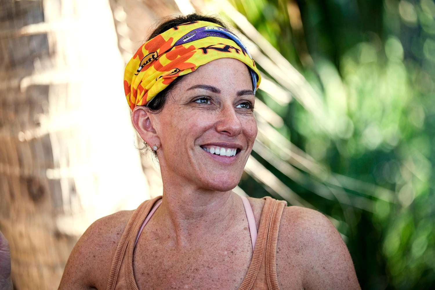 Survivor Julie Rosenberg had fire coral extracted from her leg